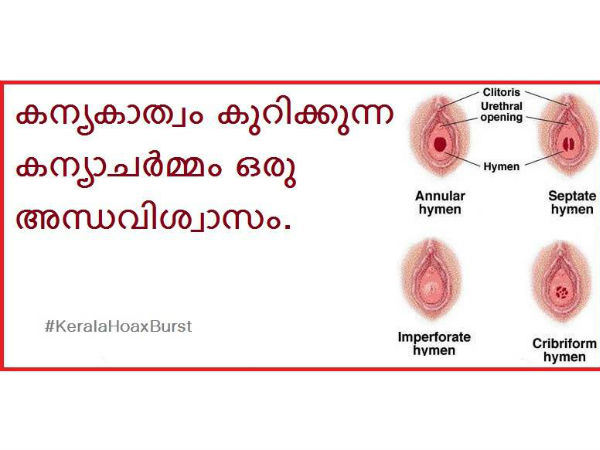 പല രൂപത്തില്‍