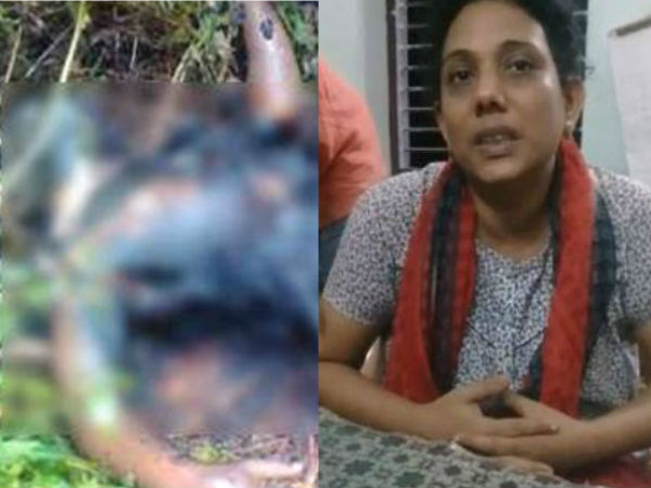 പൊള്ളലേറ്റത് എങ്ങനെ 