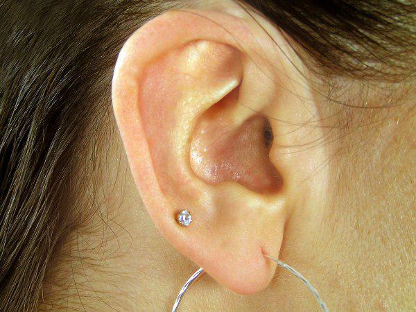 വളരെ ചെറിയ ചെവി