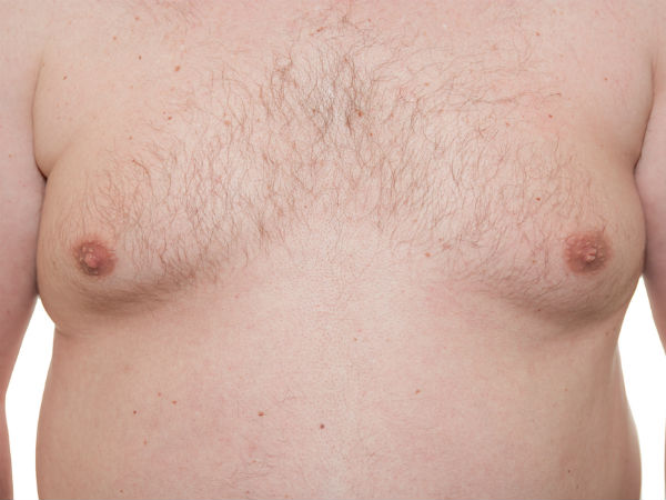 സ്ത്രൈണ സ്തനങ്ങള്‍