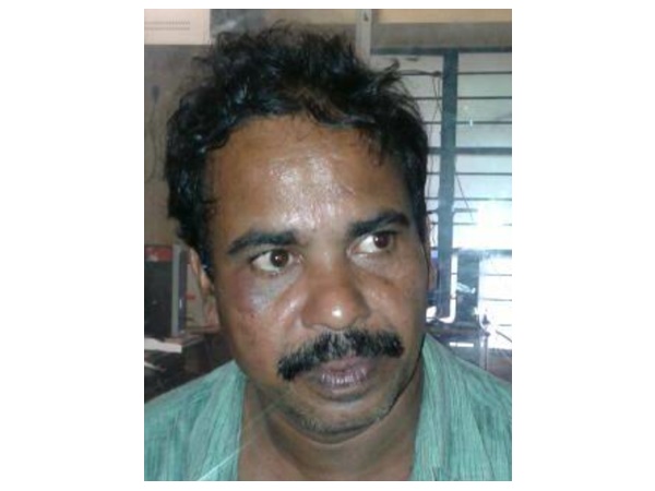 മുപ്പതോളം മുടിയിഴകൾ