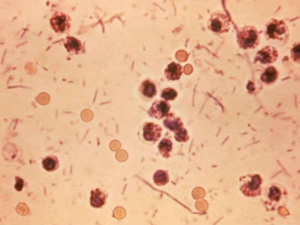 ഒരു മഹാമാരി