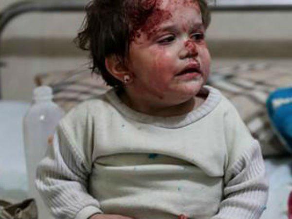 പിടഞ്ഞ് മരിക്കുമ്പോള്‍