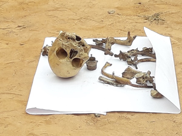 തലയോട്ടി പെൺ​കു​ട്ടി​യു​ടേ​തോ 