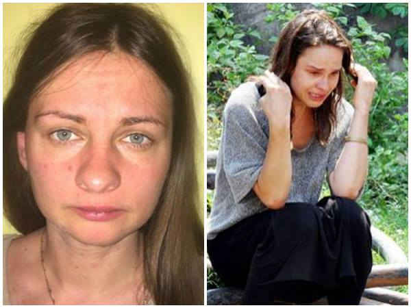 തലമുടിയും ത്വക്കിന്‍റെ ഭാഗങ്ങളും