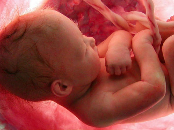 ഡോക്ടറുടെ ക്രൂരത ഇങ്ങനെ ഡോക്ടറുടെ ക്രൂരത ഇങ്ങനെ