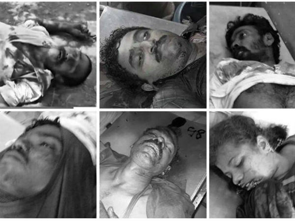 പെണ്‍കുട്ടിയെ വെടിവച്ചത് മുഖത്ത്