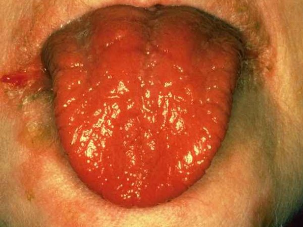 ബോധം കെട്ട് വീണു