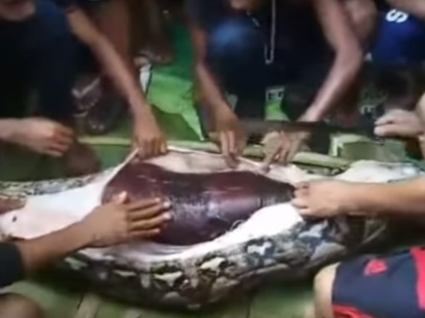 വയറുകീറി പരിശോധന