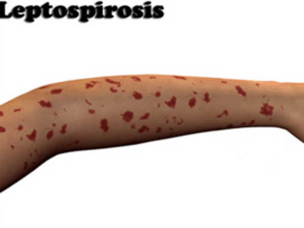 എണ്ണം വര്‍ധിക്കുന്നു