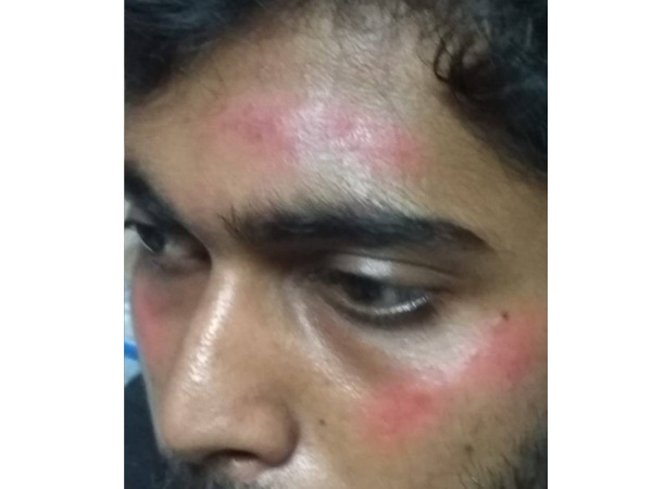 തലക്കും രണ്ട് ചെവിക്കും തോളെല്ലിനും തലക്കും രണ്ട് ചെവിക്കും തോളെല്ലിനും