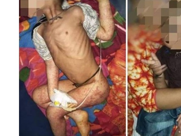 രോഗലക്ഷണം