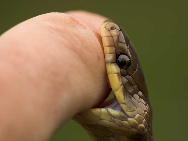 കടി ഏറ്റവരില്‍