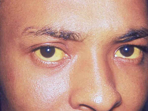 ഒന്നുകിൽ മാനസിക രോഗി