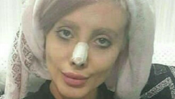 ഇറാന്റെ ആഞ്ജലീന ജോളി