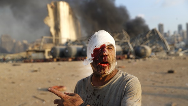 ഭക്ഷ്യ സുരക്ഷയ്ക്ക്