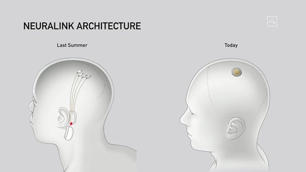 'ലിങ്ക്'
