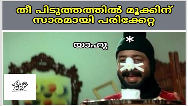 മൂക്കിനാ പരിക്ക്