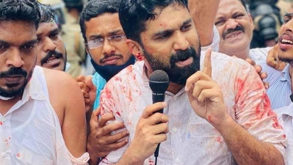 പ്രകോപനമൊന്നുമില്ലാതെ