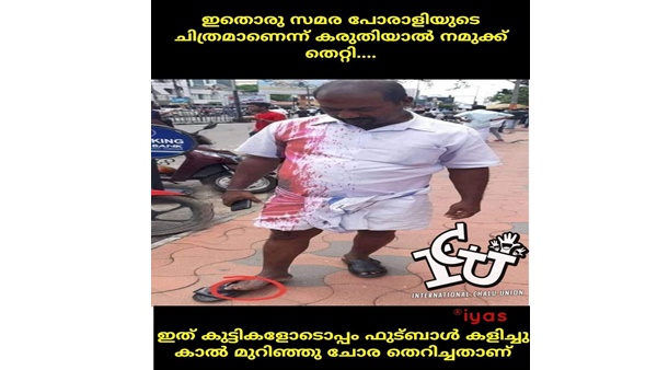 എങ്ങനെ പറ്റി