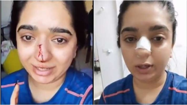 വീട്ടിൽ അതിക്രമിച്ച് കയറി അക്രമിച്ചു