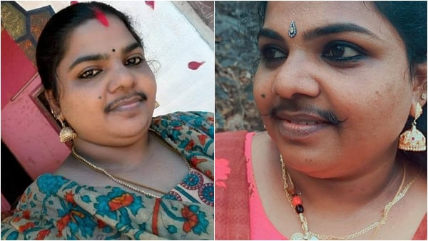 സോഷ്യല്‍മീഡിയയില്‍ ഒരുപാട് നെഗറ്റീവ് കമന്റ് വരാറുണ്ട്