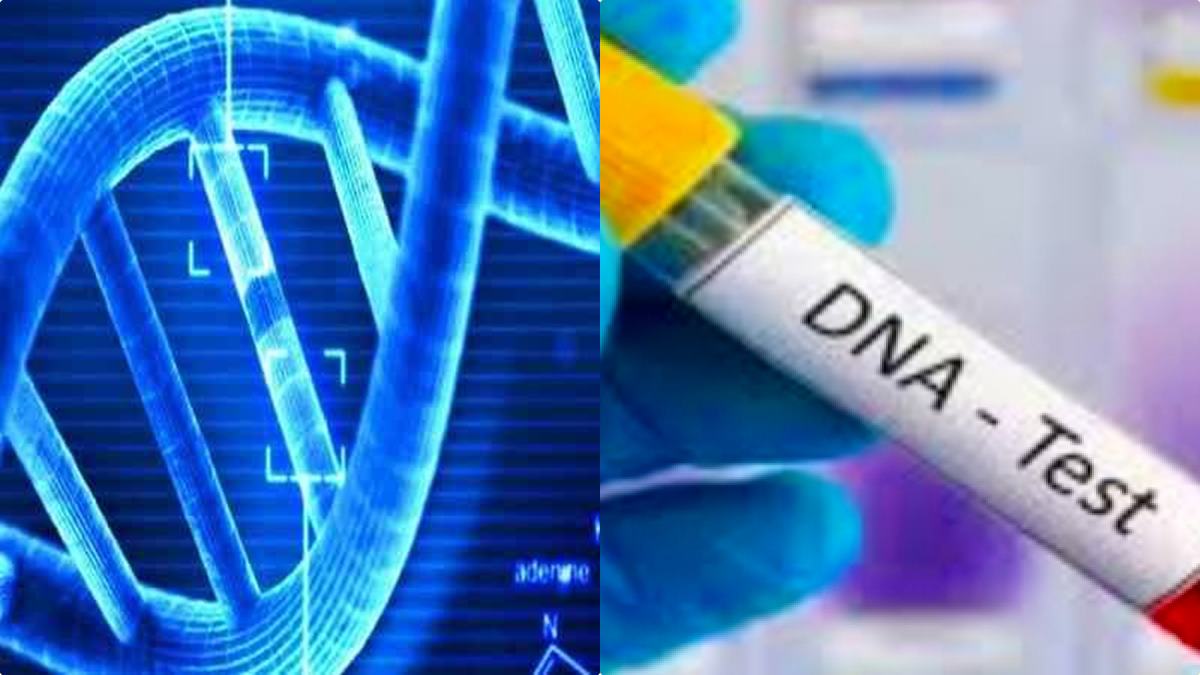 DNA TEST DNA TEST