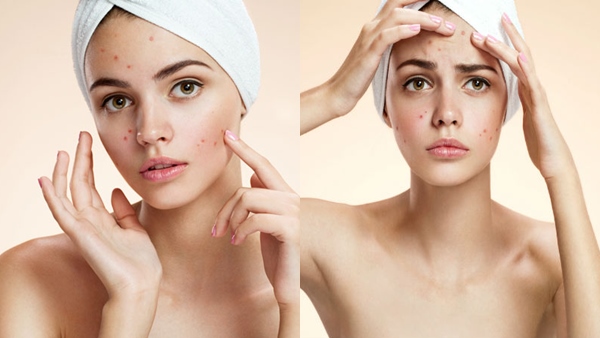 kincare