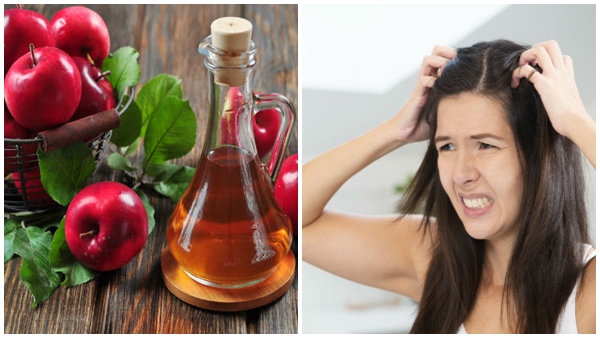 apple cider vinegar for dandruff