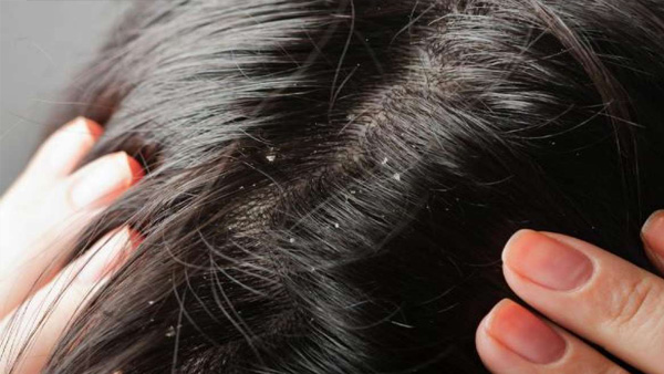 HAIR