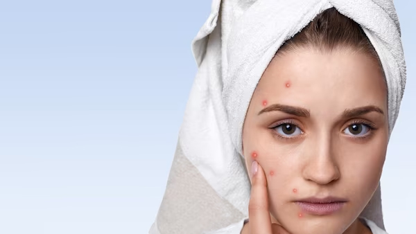 skin care
