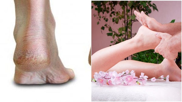 feet- feet-