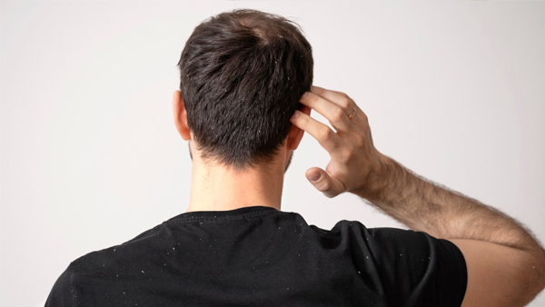 hair care tips