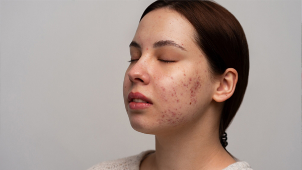 Skin Care Tips