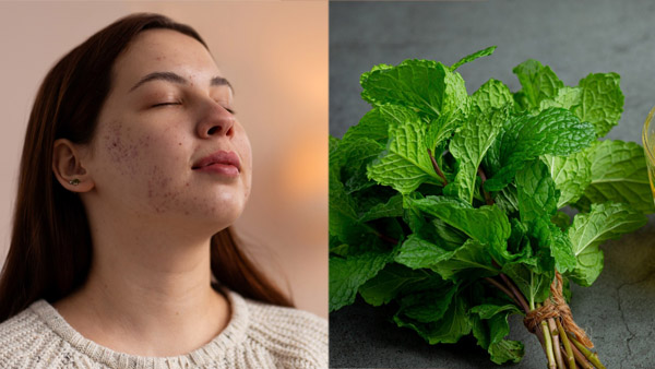 Skin Care Tips
