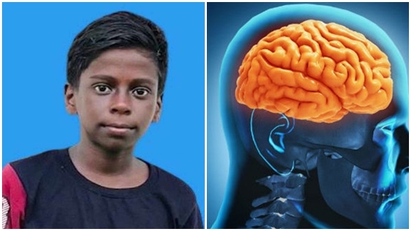 amoebicencephalitis-