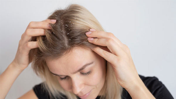 hair care tips