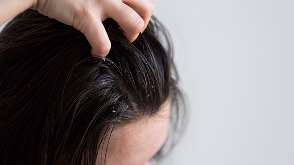 hair care tips