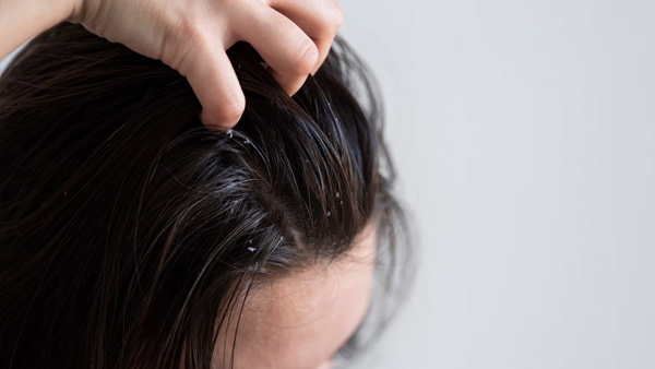 hair care tips