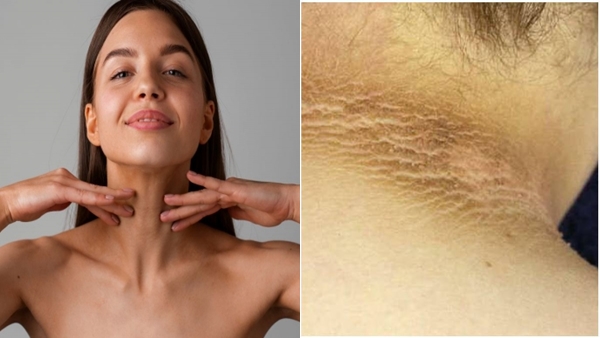 neck-
