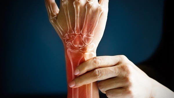 bonehealthissues