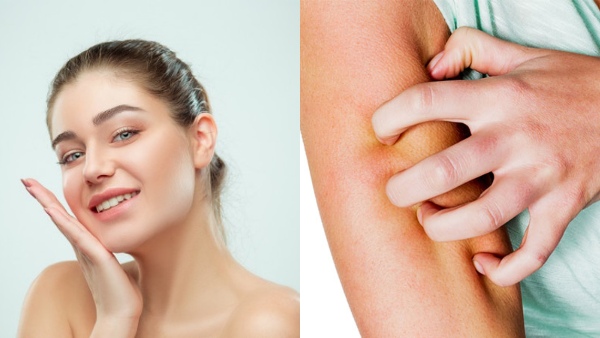 skinrash