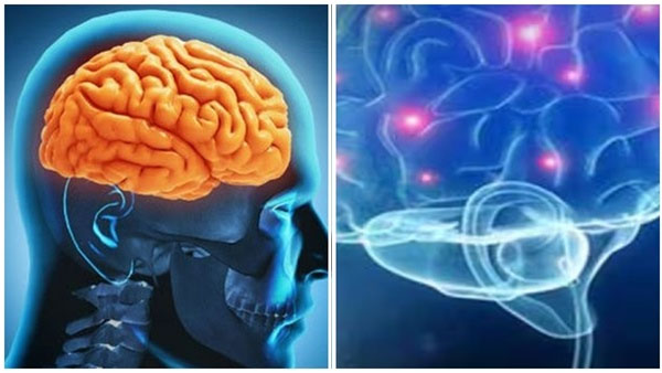 Amoebic Encephalitis