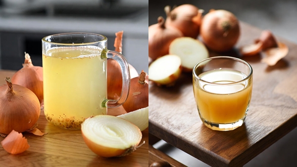 onion onion