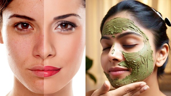 skinissues skinissues