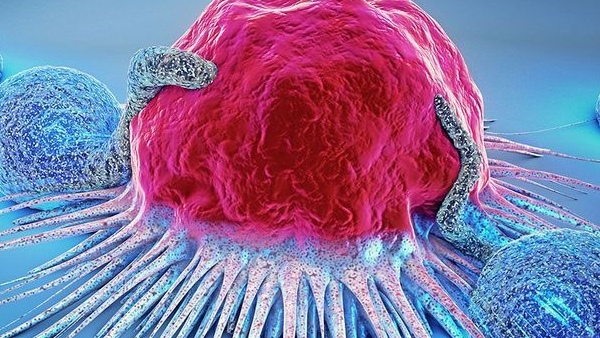 newcncer-1768460170 jpg