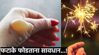दिवाळीत फटाके फोडताना तुमचे हात,पाय भाजल्यास, प्रथमोपचार काय आणि कसे करावे? वाचा एक्सपर्टच्या टीप्स