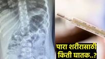 मुलाच्या तोंडात थर्मामीटर फुटला! डॉक्टरांनी पाऱ्याच्या विषापासून वाचवले प्राण, वाचा पारा किती डेंजर?