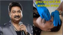 कुमार सानूवर कायरोप्रॅक्टिक थेरपी! सायनसवर झाले उपचार, कशी होते त्रासातून सुटका? घ्या जाणून 