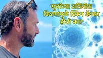 हॉलिवूड अभिनेत्याला सूर्यप्रकाशामुळे स्कीन कॅन्सर; जाणून घ्या-सूर्याची अतिनील किरणे किती धोकादायक? 